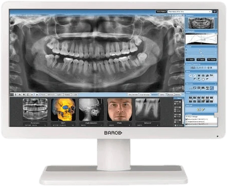 Monitor medyczny BARCO Eonis 22″ MDRC-2222 WP Dental